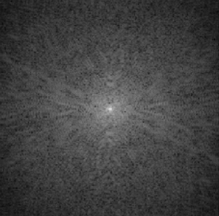 2D-kspace data of patient’s brain